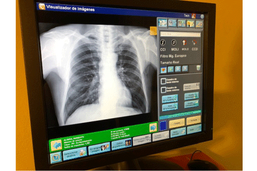 Radiologia digital
